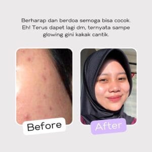 SKINSANE Bar Soap Sactea 80 gr