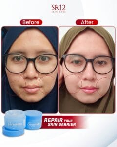 Ceramide Skin Barrier 18 gr